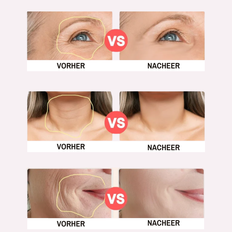 Amevia™ LiftPro – 5-in-1 Gesichtsstraffungs- & Konturierungsgerät