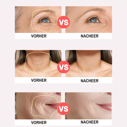 Amevia™ LiftPro – 5-in-1 Gesichtsstraffungs- & Konturierungsgerät